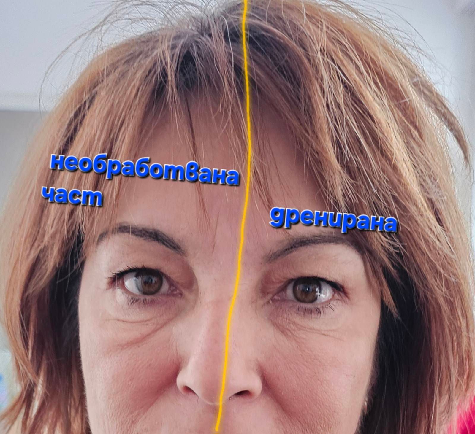 Лимфо Склупт масаж - Serenity