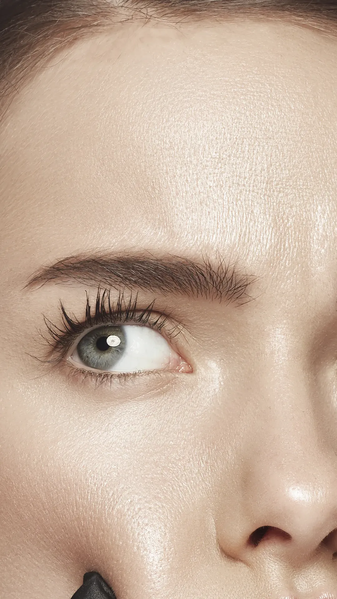 Baby Botox 1